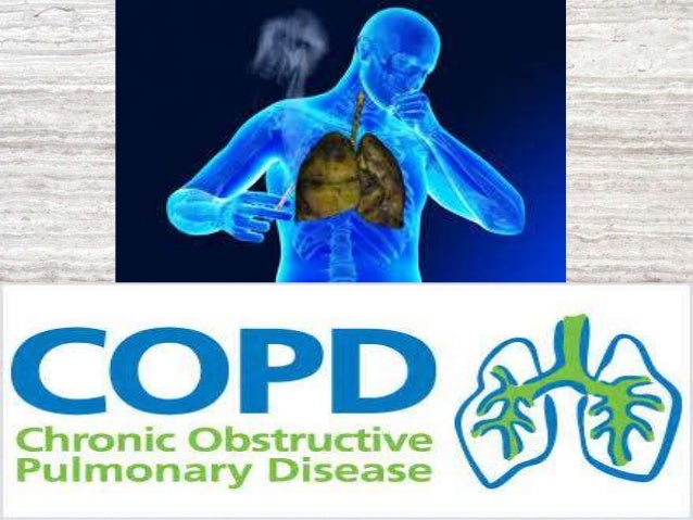 Recent advances in Asthma & COPD by Dr.Tinku Joseph Recent advances in Asthma & COPD by Dr.Tinku Joseph