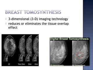  3-dimensional (3-D) imaging technology
 reduces or eliminates the tissue overlap
effect
 