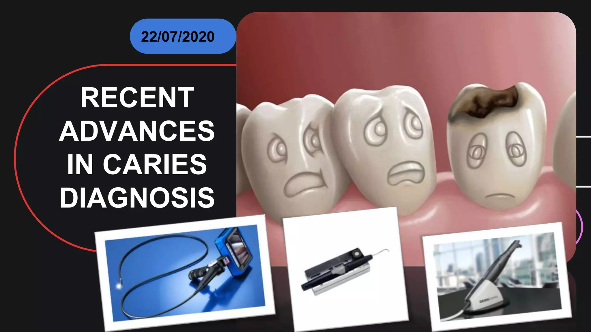 Recent advances in caries diagnosis PPT