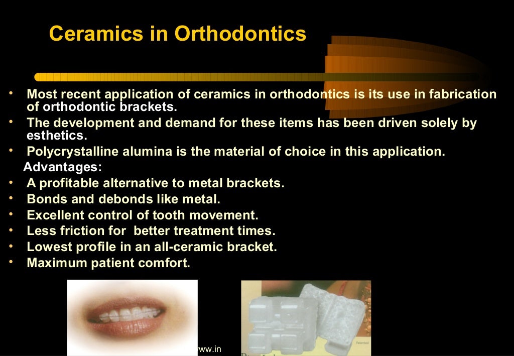 Recent advances in ceramics for dentistry/ dental implant courses