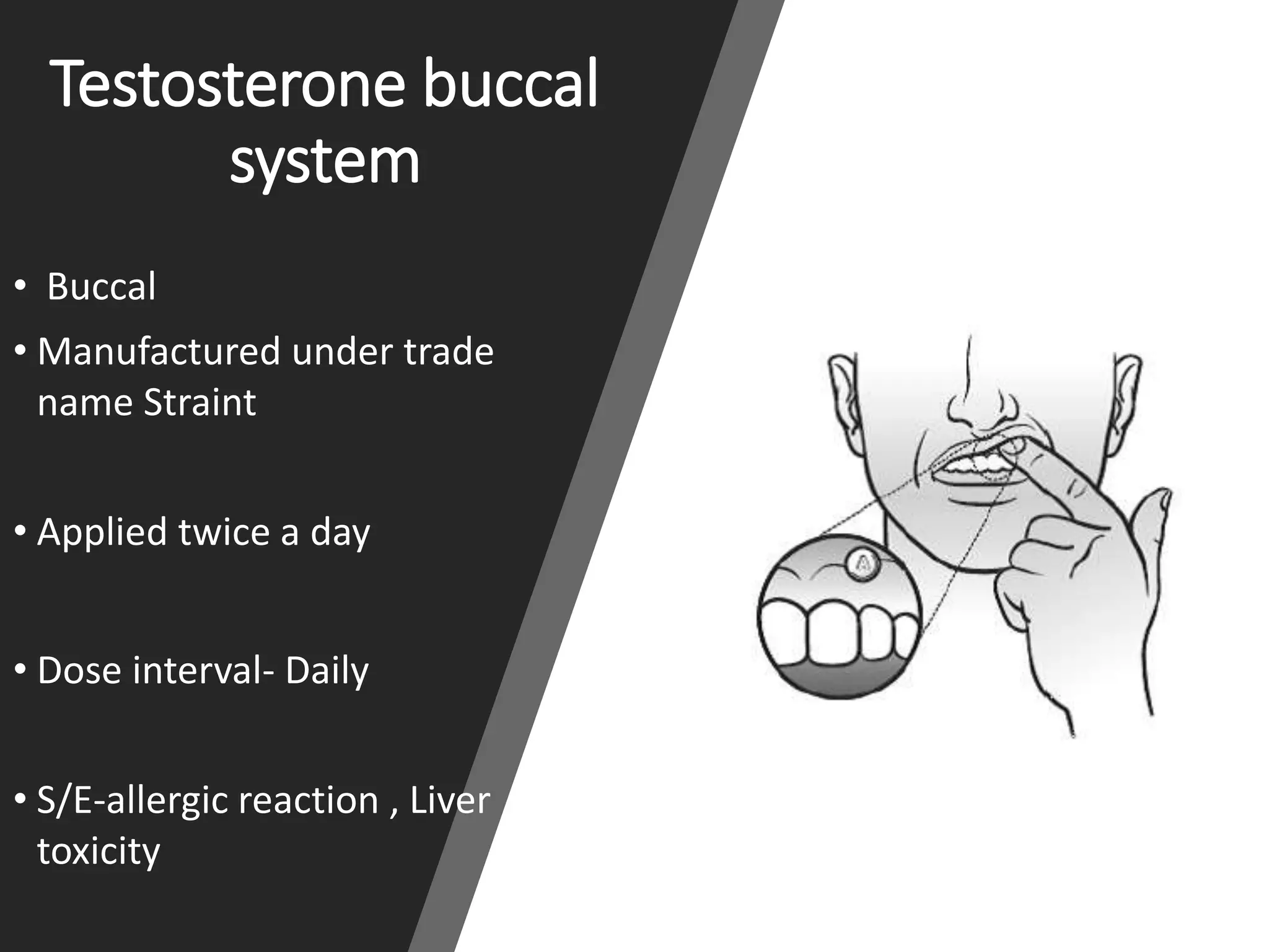 Testosterone buccal
system
• Buccal
• Manufactured under trade
name Straint
• Applied twice a day
• Dose interval- Daily
• S/E-allergic reaction , Liver
toxicity
 