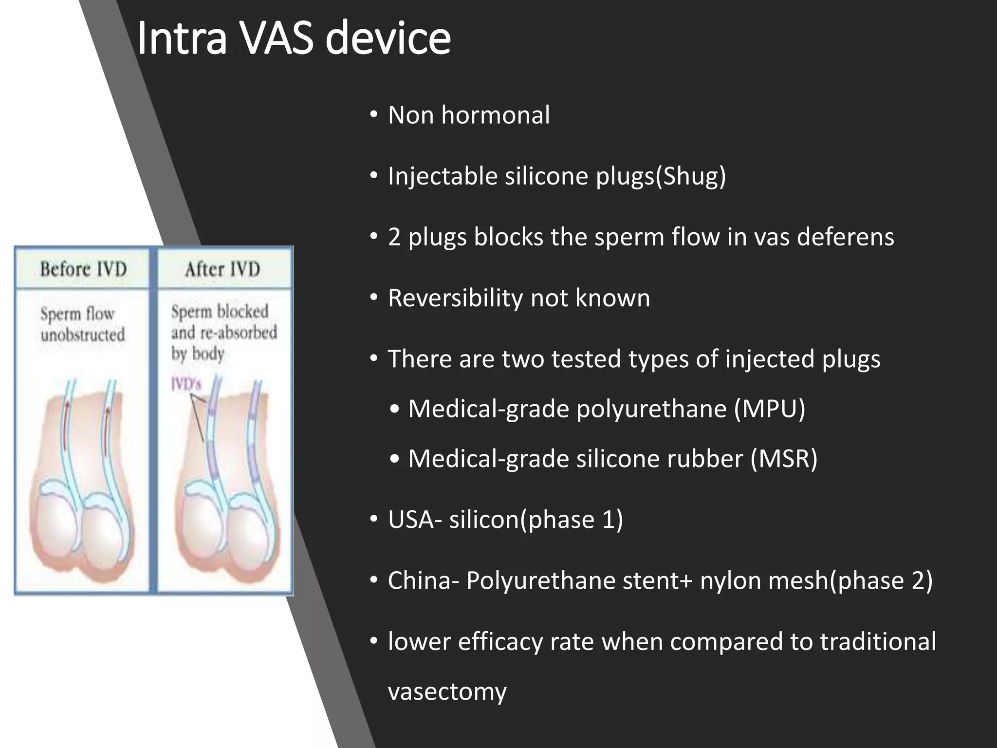 Intra VAS device
• Non hormonal
• Injectable silicone plugs(Shug)
• 2 plugs blocks the sperm flow in vas deferens
• Reversibility not known
• There are two tested types of injected plugs
• Medical-grade polyurethane (MPU)
• Medical-grade silicone rubber (MSR)
• USA- silicon(phase 1)
• China- Polyurethane stent+ nylon mesh(phase 2)
• lower efficacy rate when compared to traditional
vasectomy
 