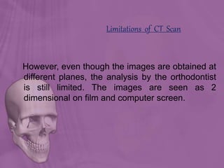 Limitations of CT Scan
However, even though the images are obtained at
different planes, the analysis by the orthodontist
is still limited. The images are seen as 2
dimensional on film and computer screen.
 