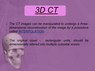  The CT images can be manipulated to undergo a three-
dimensional reconstruction of the image by a procedure
called INTERPOLATION.
 The original voxel - rectangular units, should be
dimensionally altered into multiple cuboidal voxels.
 