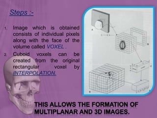 Steps :-
1. Image which is obtained
consists of individual pixels
along with the face of the
volume called VOXEL .
2. Cuboid voxels can be
created from the original
rectangular voxel by
INTERPOLATION.
 