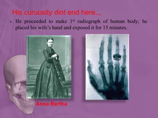 His curuosity dint end here..,
 He proceeded to make 1st radiograph of human body; he
placed his wife’s hand and exposed it for 15 minutes.
Anna Bertha
 