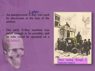 Later…
 An autopowered X-Ray was used
by physicians at the turn of the
century.
 The early X-Ray machine was
small enough to be portable, and
its tube could be operated on a
car battery.
Wires leading through a
bedroom window.
 