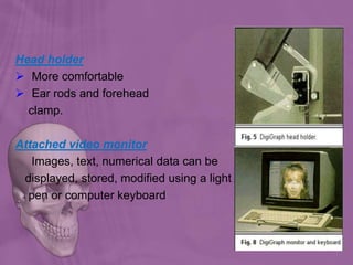 Head holder
 More comfortable
 Ear rods and forehead
clamp.
Attached video monitor
Images, text, numerical data can be
displayed, stored, modified using a light
pen or computer keyboard
 