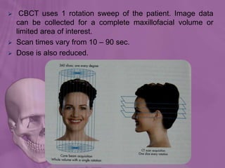  CBCT uses 1 rotation sweep of the patient. Image data
can be collected for a complete maxillofacial volume or
limited area of interest.
 Scan times vary from 10 – 90 sec.
 Dose is also reduced.
 