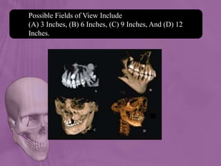 Possible Fields of View Include
(A) 3 Inches, (B) 6 Inches, (C) 9 Inches, And (D) 12
Inches.
 