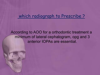 which radiograph to Prescribe ?
According to AOO for a orthodontic treatment a
minimum of lateral cephalogram, opg and 3
anterior IOPAs are essential.
 