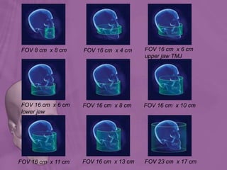 FOV 8 cm x 8 cm FOV 16 cm x 4 cm FOV 16 cm x 6 cm
upper jaw TMJ
FOV 16 cm x 6 cm
lower jaw
FOV 16 cm x 8 cm FOV 16 cm x 10 cm
FOV 16 cm x 11 cm FOV 16 cm x 13 cm FOV 23 cm x 17 cm
 