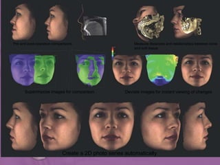 Create a 2D photo series automatically
Pre and post-operative comparisons Measure distances and relationships between bone
and soft tissue
Superimpose images for comparison Deviate images for instant viewing of changes
 