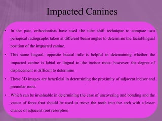 Impacted Canines
• In the past, orthodontists have used the tube shift technique to compare two
periapical radiographs taken at different beam angles to determine the facial/lingual
position of the impacted canine.
• This same lingual, opposite buccal rule is helpful in determining whether the
impacted canine is labial or lingual to the incisor roots; however, the degree of
displacement is difficult to determine
• These 3D images are beneficial in determining the proximity of adjacent incisor and
premolar roots.
• Which can be invaluable in determining the ease of uncovering and bonding and the
vector of force that should be used to move the tooth into the arch with a lesser
chance of adjacent root resorption
 