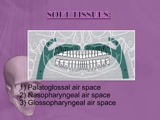 1) Palatoglossal air space
2) Nasopharyngeal air space
3) Glossopharyngeal air space
 