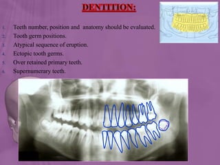 1. Teeth number, position and anatomy should be evaluated.
2. Tooth germ positions.
3. Atypical sequence of eruption.
4. Ectopic tooth germs.
5. Over retained primary teeth.
6. Supernumerary teeth.
 