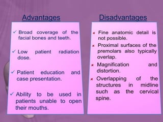 Advantages Disadvantages
 