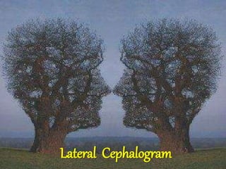 30
Lateral Cephalogram
 