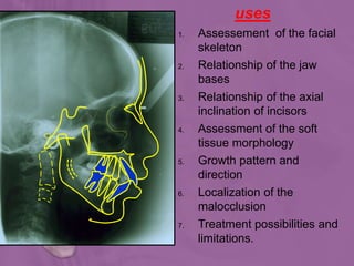 uses
1. Assessement of the facial
skeleton
2. Relationship of the jaw
bases
3. Relationship of the axial
inclination of incisors
4. Assessment of the soft
tissue morphology
5. Growth pattern and
direction
6. Localization of the
malocclusion
7. Treatment possibilities and
limitations.
 