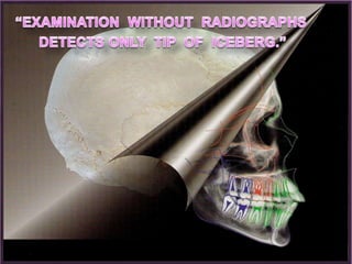 Ortho radio diagnosis
4
 