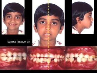 40
Suhana Tabasum 7/F
 