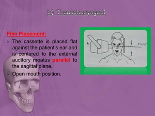 Film Placement:
 The cassette is placed flat
against the patient's ear and
is centered to the external
auditory meatus parallel to
the sagittal plane.
 Open mouth position.
 