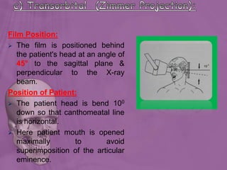 Film Position:
 The film is positioned behind
the patient's head at an angle of
45° to the sagittal plane &
perpendicular to the X-ray
beam.
Position of Patient:
 The patient head is bend 100
down so that canthomeatal line
is horizontal.
 Here patient mouth is opened
maximally to avoid
superimposition of the articular
eminence.
 