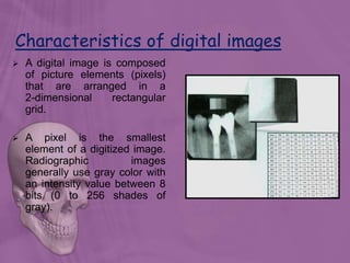 Characteristics of digital images
 A digital image is composed
of picture elements (pixels)
that are arranged in a
2-dimensional rectangular
grid.
 A pixel is the smallest
element of a digitized image.
Radiographic images
generally use gray color with
an intensity value between 8
bits (0 to 256 shades of
gray).
 