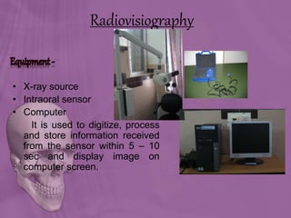 • X-ray source
• Intraoral sensor
• Computer
It is used to digitize, process
and store information received
from the sensor within 5 – 10
sec and display image on
computer screen.
Radiovisiography
 