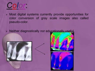 Color:
 Most digital systems currently provide opportunities for
color conversion of gray scale images also called
pseudo-color.
 Neither diagnostically nor educationally useful.
 
