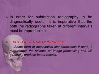  In order for subtraction radiography to be
diagnostically useful, it is imperative that the
both the radiographs taken at different intervals
must be reproducible.
 BUT IT IS VIRTUALLY IMPOSSIBLE.
Some form of mechanical standardization if done, it
may reduce the reliance on image processing and will
generally produce better results.
 