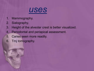 uses
1. Mammography.
2. Sialography.
3. Height of the alveolar crest is better visualized.
4. Periodontal and periapical assessment.
5. Caries seen more readily.
6. Tmj tomography.
 