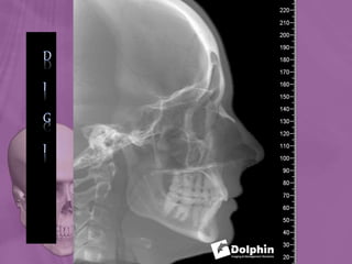 Ortho radio diagnosis
 