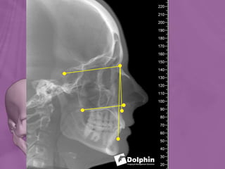 Ortho radio diagnosis
 
