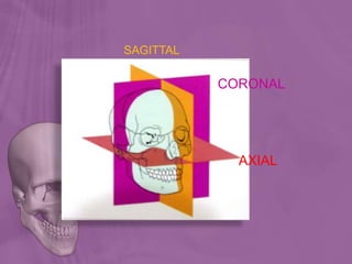 AXIAL
SAGITTAL
CORONAL
 