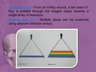  Single slice CT – From an X-Ray source, a fan beam X-
Ray is emitted through the imaged object towards a
single array of detectors.
 Multiple slice CT – Multiple slices can be produced
using adjacent detector arrays.
 