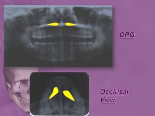 Ortho radio diagnosis
 