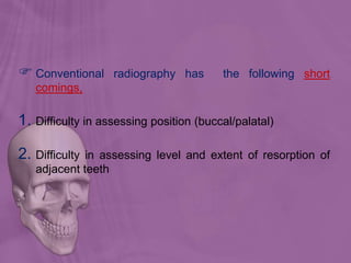  Conventional radiography has the following short
comings,
1. Difficulty in assessing position (buccal/palatal)
2. Difficulty in assessing level and extent of resorption of
adjacent teeth
 