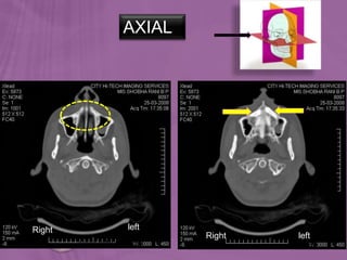 96
AXIAL
Ortho radio diagnosis
Right left
Right left
 