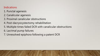 Indications
1. Punctal agenesis
2. Canalicular agenesis
3. Proximal canalicular obstructions
4. Post-dacryocystectomy rehabilitation
5. Multiple times failed DCR with canalicular obstructions
6. Lacrimal pump failures
7. Unresolved epiphora following a patent DCR
 