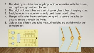 1. The ideal bypass tube is nonhydrophobic, nonreactive with the tissues,
and rigid enough not to collapse.
2. The original Jones tubes are a set of pyrex glass tubes of varying sizes;
3. Straight tubes are more commonly used than curved tubes
4. Flanges with holes have also been designed to secure the tube by
passing suture through the holes.
5. Gold-plated dilators and tube measuring slabs are available with the
complete set
 