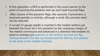 1. In this operation, a DCR is performed in the usual manner to the
point of suturing the posterior tear sac and nasal mucosal flaps.
2. After closure of the posterior flaps, the caruncle, if prominent, is
removed partially or entirely, although a small, flat caruncle need
not be resected.
3. A curved 23-gauge needle is inserted in the medial canthus just
beneath the lower lid 2 mm posterior to the cutaneous margin of
the medial commissure and advanced in a direction that enables its
point to emerge just posterior to the anterior lacrimal sac flap
midway between the tear sac fundus and the isthmus, but anterior
to the body of the middle turbinate.
 