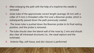 4. After enlarging the path with the help of a trephine the needle is
removed.
5. Jones tube of the approximate correct length (average 18 mm with a
collar of 4 mm) is threaded collar first over a Bowman probe, which is
subsequently passed down the path previously created.
6. The Jones tube is pushed down the Bowman probe to its final resting
position, and the probe is removed .
7. The tube should clear the lateral wall of the nose by 2 mm and should
also clear all intranasal structures (i.e., the nasal septum and the
turbinate).
8. Anterior flap, soft tissue, and skin closure is performed
 