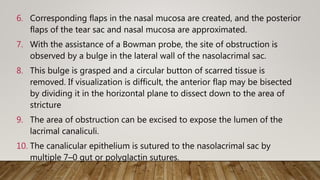 6. Corresponding flaps in the nasal mucosa are created, and the posterior
flaps of the tear sac and nasal mucosa are approximated.
7. With the assistance of a Bowman probe, the site of obstruction is
observed by a bulge in the lateral wall of the nasolacrimal sac.
8. This bulge is grasped and a circular button of scarred tissue is
removed. If visualization is difficult, the anterior flap may be bisected
by dividing it in the horizontal plane to dissect down to the area of
stricture
9. The area of obstruction can be excised to expose the lumen of the
lacrimal canaliculi.
10. The canalicular epithelium is sutured to the nasolacrimal sac by
multiple 7–0 gut or polyglactin sutures.
 