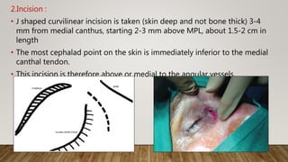 2.Incision :
• J shaped curvilinear incision is taken (skin deep and not bone thick) 3-4
mm from medial canthus, starting 2-3 mm above MPL, about 1.5-2 cm in
length
• The most cephalad point on the skin is immediately inferior to the medial
canthal tendon.
• This incision is therefore above or medial to the angular vessels.
 
