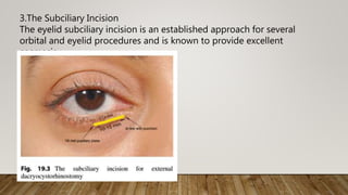 3.The Subciliary Incision
The eyelid subciliary incision is an established approach for several
orbital and eyelid procedures and is known to provide excellent
cosmesis
 