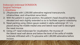 Endoscopic endonasal DCR(EEDCR)
Surgical Technique
1. Anesthesia
1) 2%xylocaine with 1:200,000 adrenaline regional transcaruncle,
infratrochlear, and infraorbital nerve block.
2) With the patient in supine position, the patient’s head should be slightly
elevated and neck slightly extended so as to facilitate superior osteotomy
3) Nasal packing using ribbon gauze soaked in alpha-adrenergic VC ‘s is
placed along the middle meatal area and lateral nasal wall to decongest
the nasal mucosa.
4) Using a 0° nasal endoscope for visualization, the mucosa of
the lateral nasal wall above and below the level of the axilla of middle
turbinate infiltrated with 2 % xylocaine with 1:80,000 adrenaline before
incision.
 
