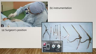 (a) Surgeon's position
(b) instrumentation
 