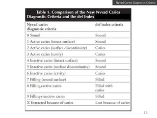 Nyvad Caries Diagnostic Criteria

13

 