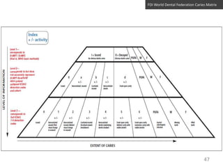 FDI World Dental Federation Caries Matrix

47

 